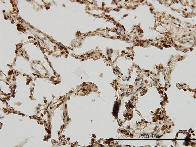 Monoclonal Anti-IRAK1, (C-terminal) antibody produced in mouse