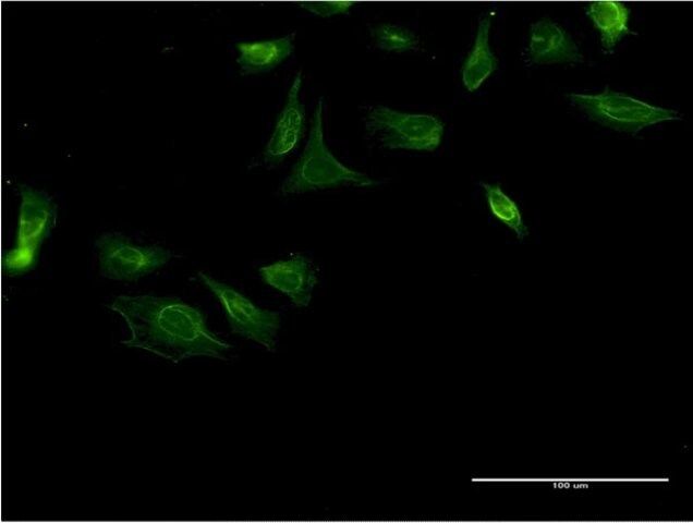 Monoclonal Anti-ITGA4 antibody produced in mouse