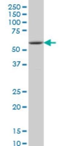 Monoclonal Anti-IRAK2 antibody produced in mouse