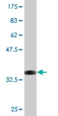 Monoclonal Anti-ITGB6 antibody produced in mouse