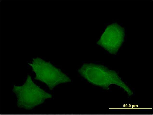 Monoclonal Anti-IREB2 antibody produced in mouse