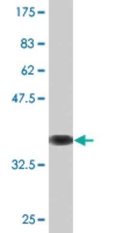 Monoclonal Anti-ITGA7 antibody produced in mouse