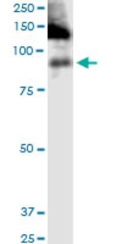 Monoclonal Anti-ITGB2 antibody produced in mouse