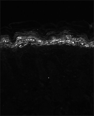 Monoclonal Anti-KCNA5 antibody produced in mouse