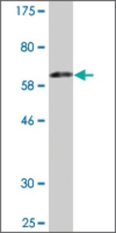 Monoclonal Anti-KDSR antibody produced in mouse