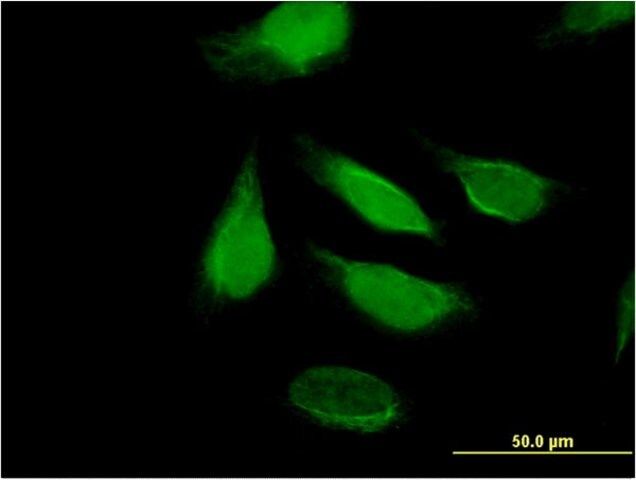 Monoclonal Anti-KIAA1008 antibody produced in mouse