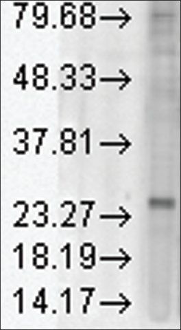 Monoclonal Anti-KDELR1 antibody produced in mouse