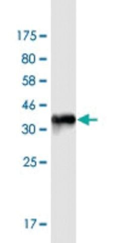 Monoclonal Anti-KCNJ5 antibody produced in mouse