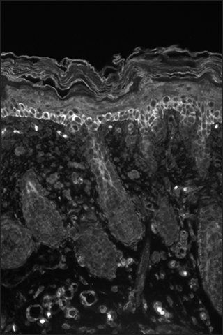 Monoclonal Anti-KCNA6 antibody produced in mouse