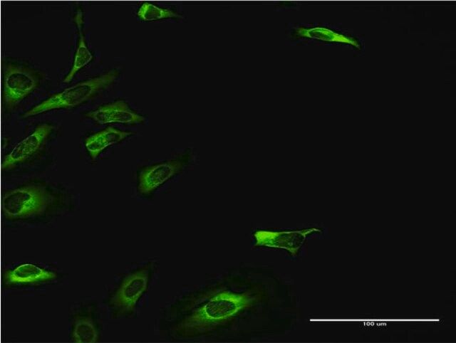 Monoclonal Anti-KHK antibody produced in mouse