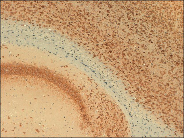 Monoclonal Anti-KCNB1 antibody produced in mouse