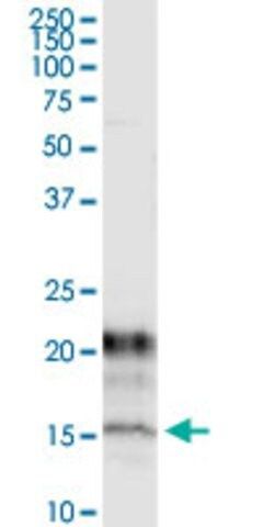 Monoclonal Anti-KCNE1 antibody produced in mouse