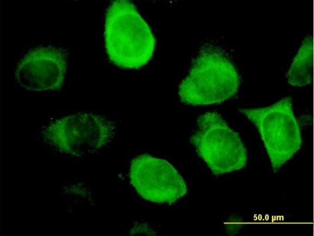 Monoclonal Anti-KRT18 antibody produced in mouse