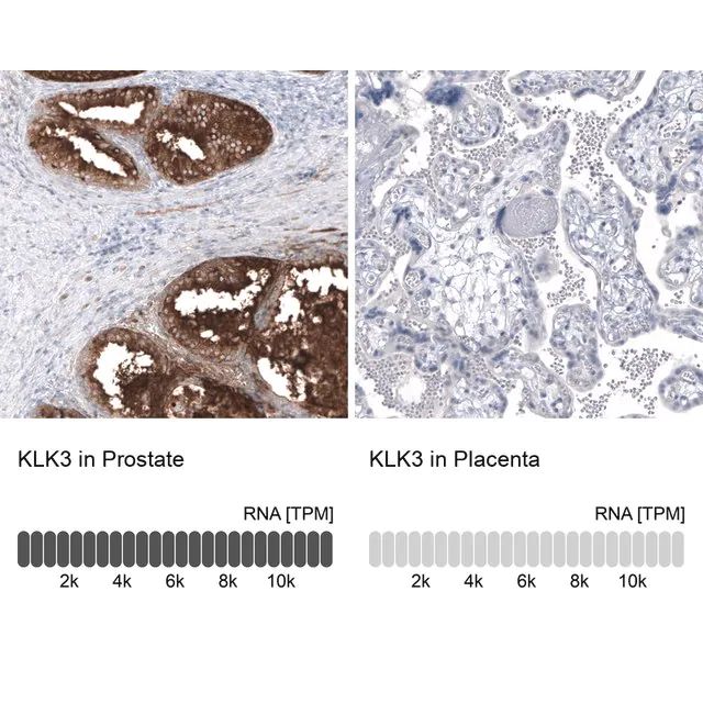 Monoclonal Anti-KLK3 antibody produced in mouse