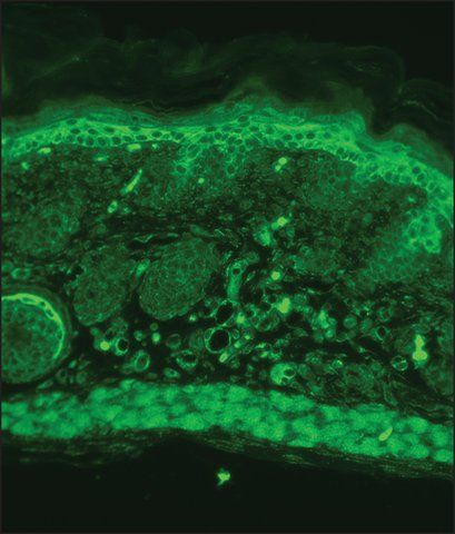 Monoclonal Anti-KCNJ12 antibody produced in mouse