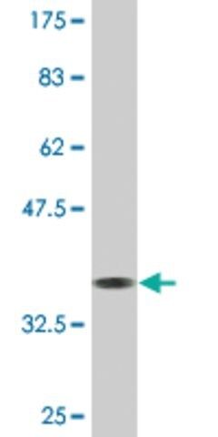 Monoclonal Anti-KLF8, (N-terminal) antibody produced in mouse