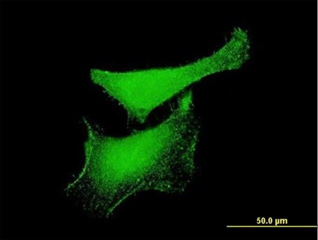 Monoclonal Anti-KLF6, (N-terminal) antibody produced in mouse