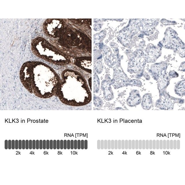 Monoclonal Anti-KLK3 antibody produced in mouse