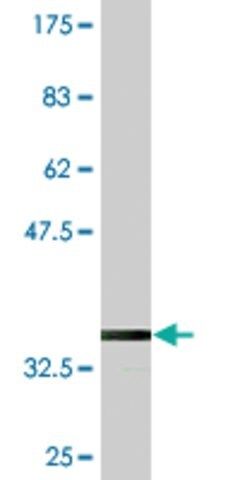 Monoclonal Anti-KLHL2, (N-terminal) antibody produced in mouse