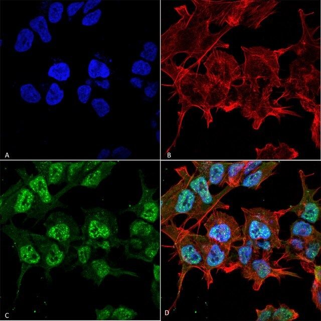 Monoclonal Anti-GABA A Receptor antibody produced in mouse