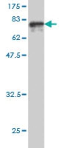 Monoclonal Anti-GPT antibody produced in mouse