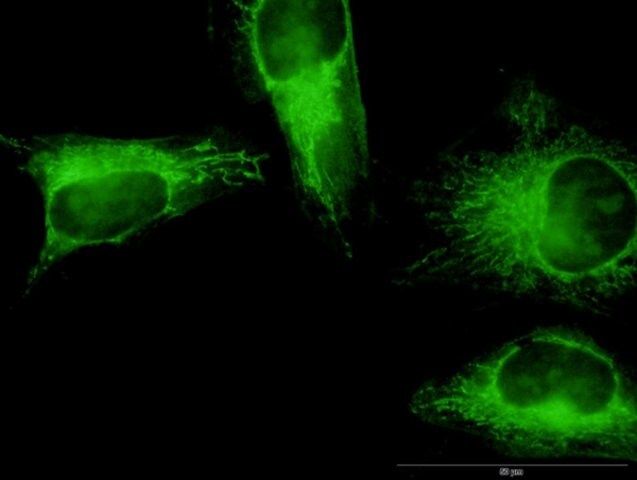 Monoclonal Anti-GSDML antibody produced in mouse