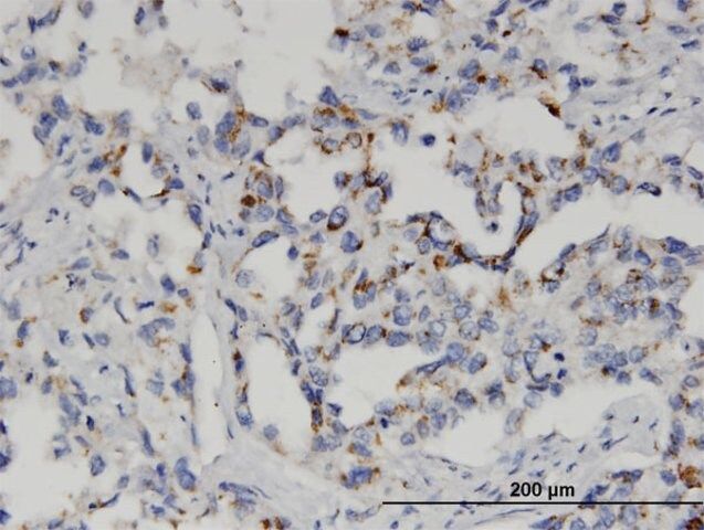 Monoclonal Anti-GSTM2 antibody produced in mouse