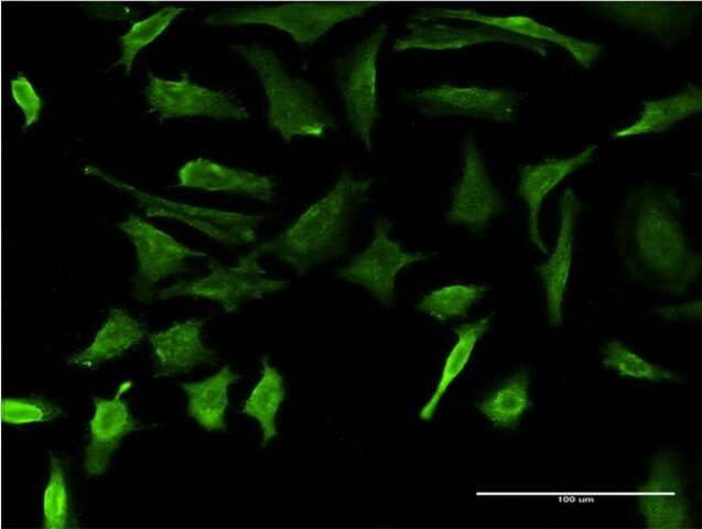 Monoclonal Anti-DMP1 antibody produced in mouse