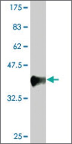 Monoclonal Anti-DLG1, (N-terminal) antibody produced in mouse