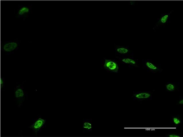 Monoclonal Anti-DLX2 antibody produced in mouse