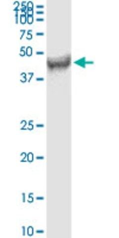 Monoclonal Anti-FDFT1 antibody produced in mouse