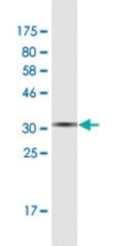 Monoclonal Anti-FERMT1 antibody produced in mouse