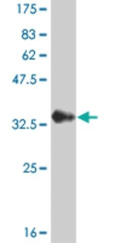 Monoclonal Anti-CHP antibody produced in mouse