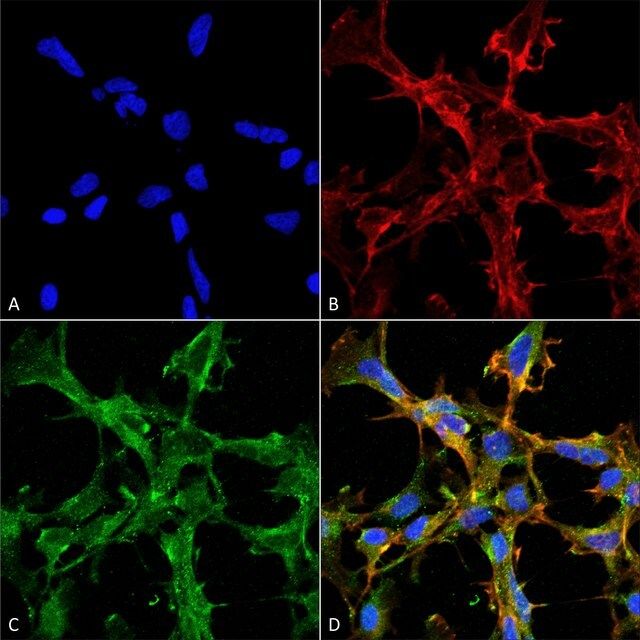 Monoclonal Anti-Citrulline antibody produced in mouse