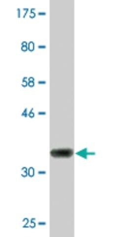 Monoclonal Anti-CIDEC antibody produced in mouse