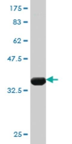 Monoclonal Anti-CHERP antibody produced in mouse