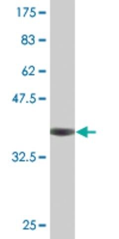 Monoclonal Anti-CDY2A antibody produced in mouse