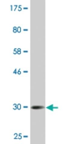 Monoclonal Anti-CGB2, (N-terminal) antibody produced in mouse