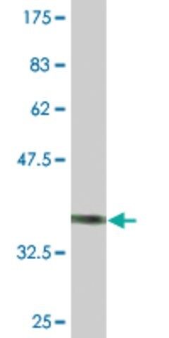 Monoclonal Anti-CHODL antibody produced in mouse