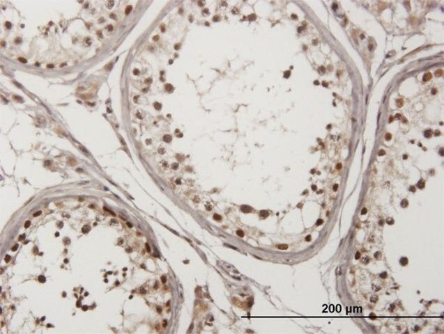 Monoclonal Anti-CHEK2 antibody produced in mouse