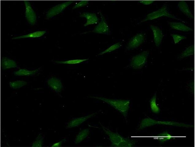 Monoclonal Anti-CHST3 antibody produced in mouse