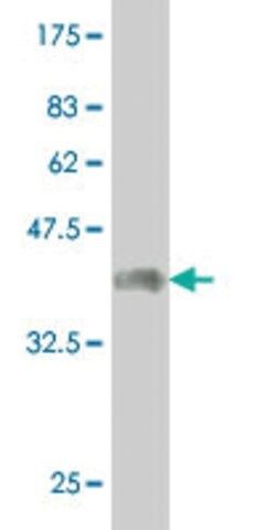 Monoclonal Anti-CER1 antibody produced in mouse