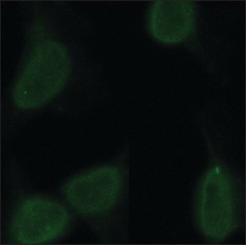 Monoclonal Anti-CHD1 antibody produced in rat