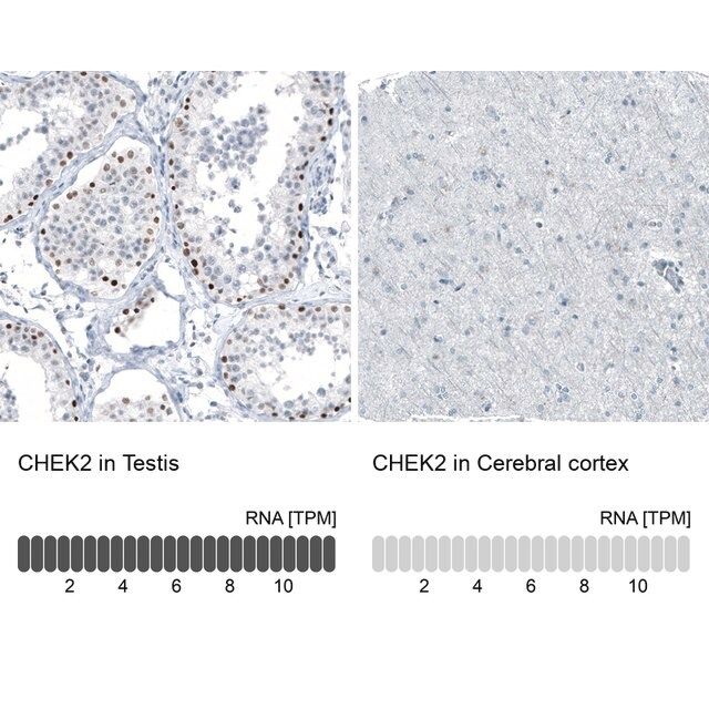 Monoclonal Anti-CHEK2 antibody produced in mouse