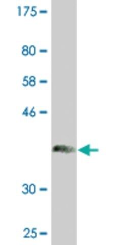 Monoclonal Anti-CHIT1 antibody produced in mouse