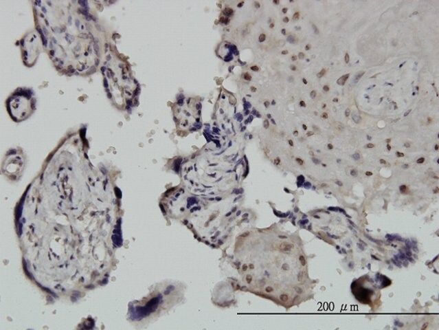 Monoclonal Anti-CHUK, (C-terminal) antibody produced in mouse