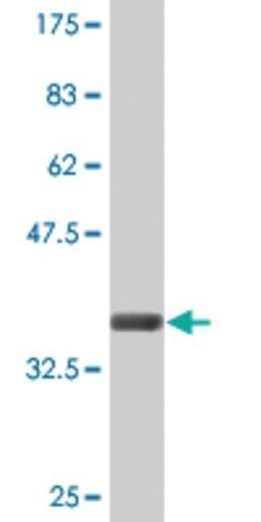 Monoclonal Anti-CLCN7, (C-terminal) antibody produced in mouse