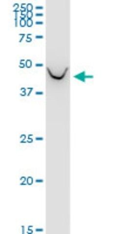 Monoclonal Anti-BCAT1 antibody produced in mouse