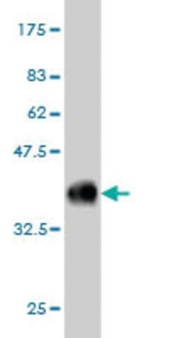 Monoclonal Anti-CABC1 antibody produced in mouse