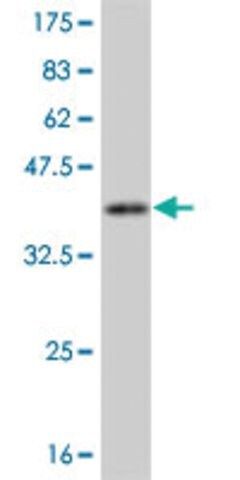 Monoclonal Anti-CAMK1, (C-terminal) antibody produced in mouse